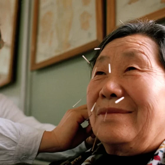 Acupuntura é pseudociência?