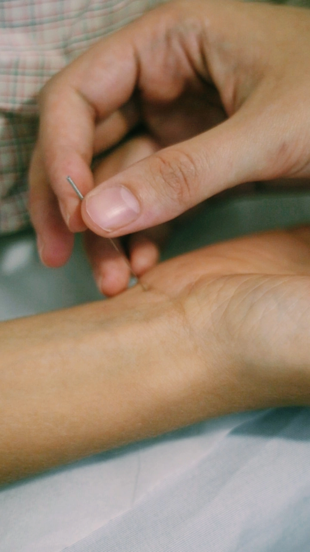 Acupuntura, técnica da Medicina Tradicional Chinesa