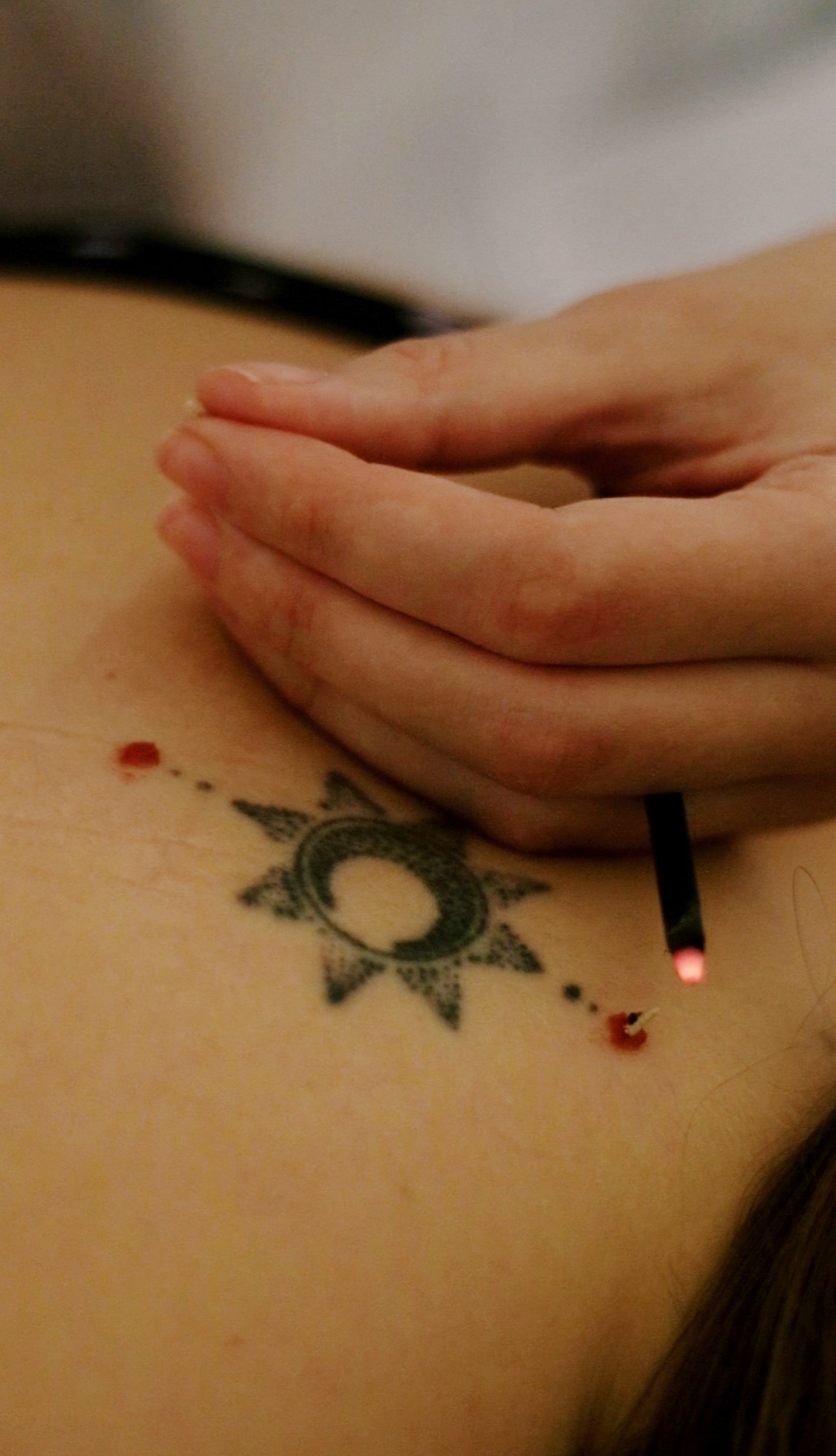 moxabustao japonesa okyu