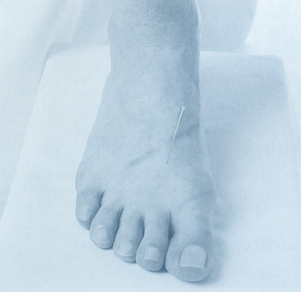 Ponto de Acupuntura Fígado 3 (Taichong)