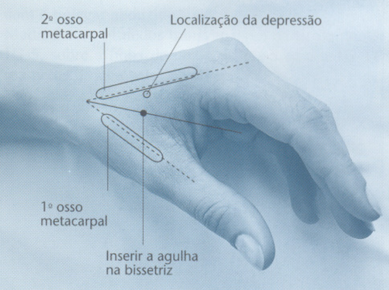 Localização do ponto IG4